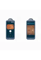 Volk Volk Viva-Non Mydriatic fundus camera