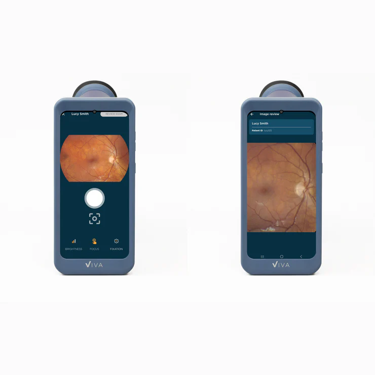 Volk Viva-Non Mydriatic fundus camera