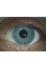 Keeler Keeler digitale spleetlamp met camera, Z-type met 5 vergrotingen