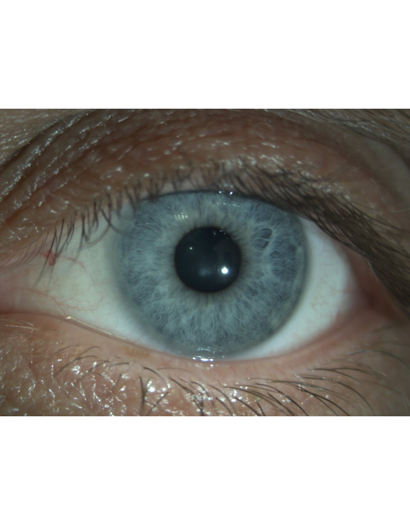 Keeler Keeler digitale spleetlamp met camera, HS-type met 5 vergrotingen