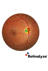 RetinaLyze RetinaLyze abonnement per maand