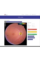 RetinaLyze RetinaLyze abonnement per maand