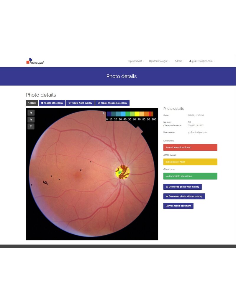 RetinaLyze RetinaLyze abonnement per maand