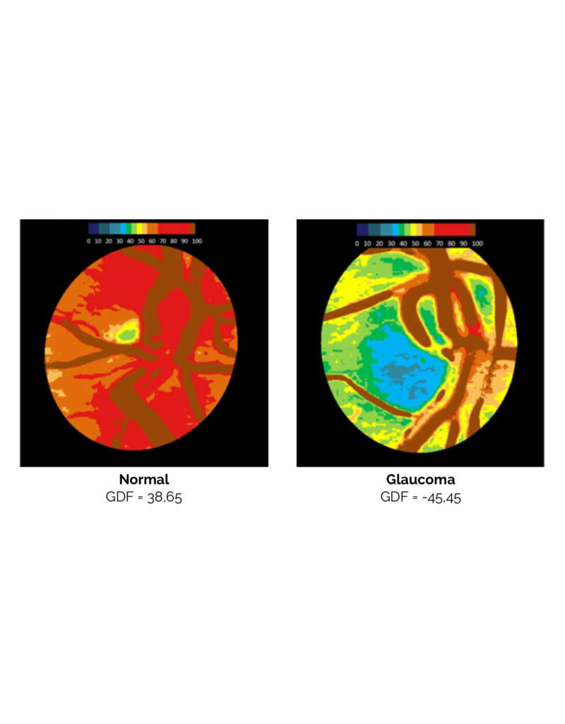 RetinaLyze RetinaLyze abonnement per maand