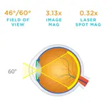 Volk 20D Dubbel Asferische Lens – Standaard voor indirecte ophthalmoscopie