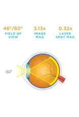 Volk Volk 20D Dubbel Asferische Lens – Standaard voor indirecte ophthalmoscopie