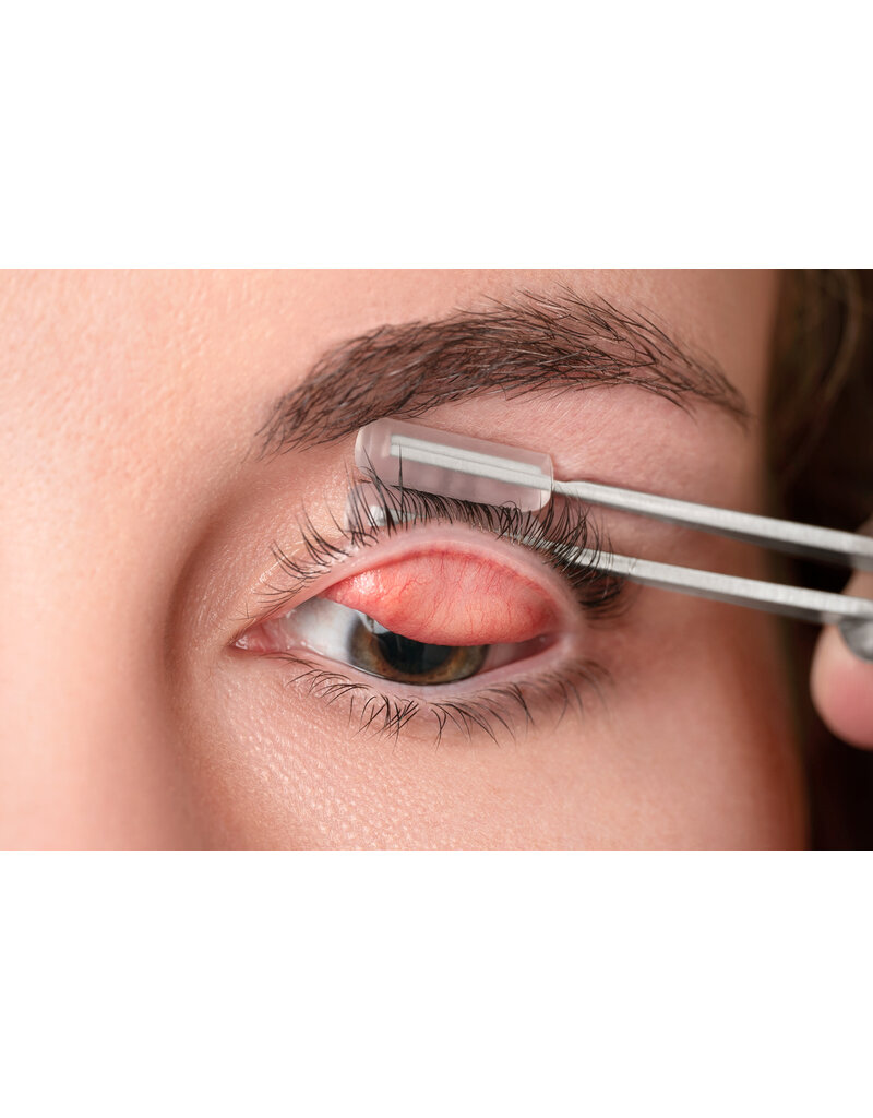 Meivertor Meivertor® hygiënische disposable tips voor ooglidomklapper – 100 Paar