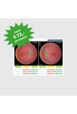 RetinaLyze RetinaLyze abonnement per maand