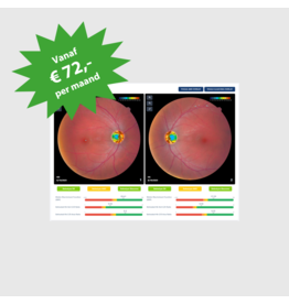 RetinaLyze RetinaLyze abonnement per maand, snelle AI-analyse van fundusfoto's en OCT-scans