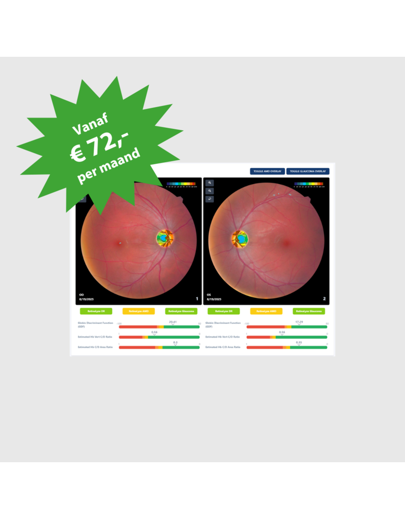 RetinaLyze RetinaLyze abonnement per maand