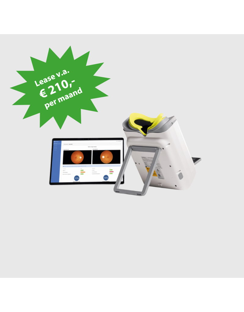 EyeVinci EyeVinci funduscamera met Assure + slimme AI-software