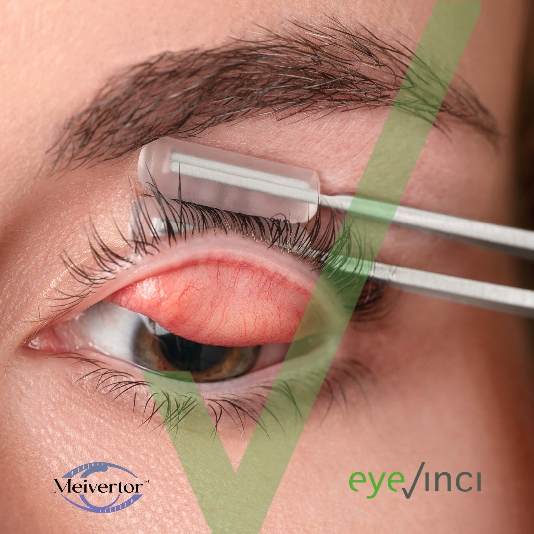 Nieuw bij EyeVinci: de Meivertor