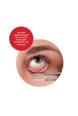 Meivertor Professionele ooglidomklapper voor snel, comfortabel en hygiënisch oogonderzoek met één hand.