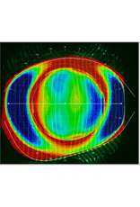 Medmont Medmont Meridia™ Vantage – All-in-One topograaf voor  sclera- en corneatopografie, contactlenzen en droge ogen.