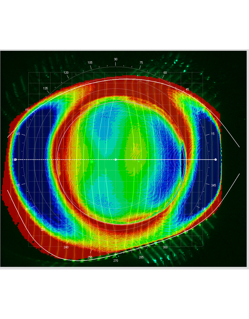 Medmont Medmont Meridia™ Vantage – All-in-One topograaf voor  sclera- en corneatopografie, contactlenzen en droge ogen.
