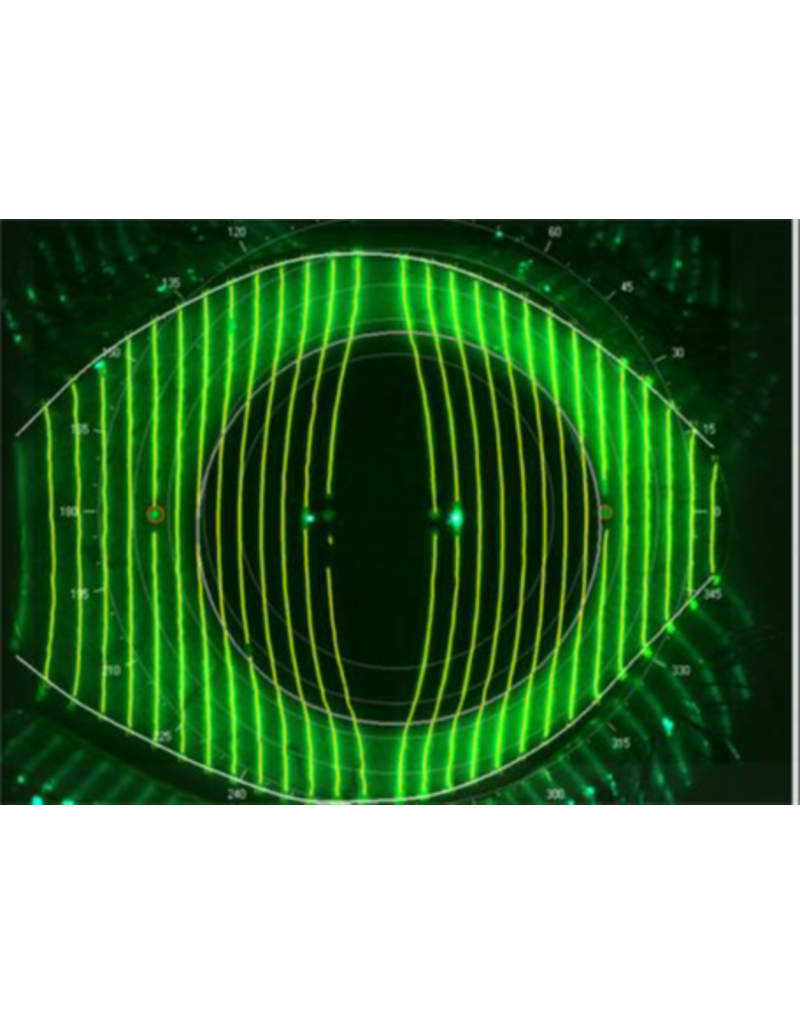Medmont Medmont Meridia™ Vantage – All-in-One topograaf voor  sclera- en corneatopografie, contactlenzen en droge ogen.