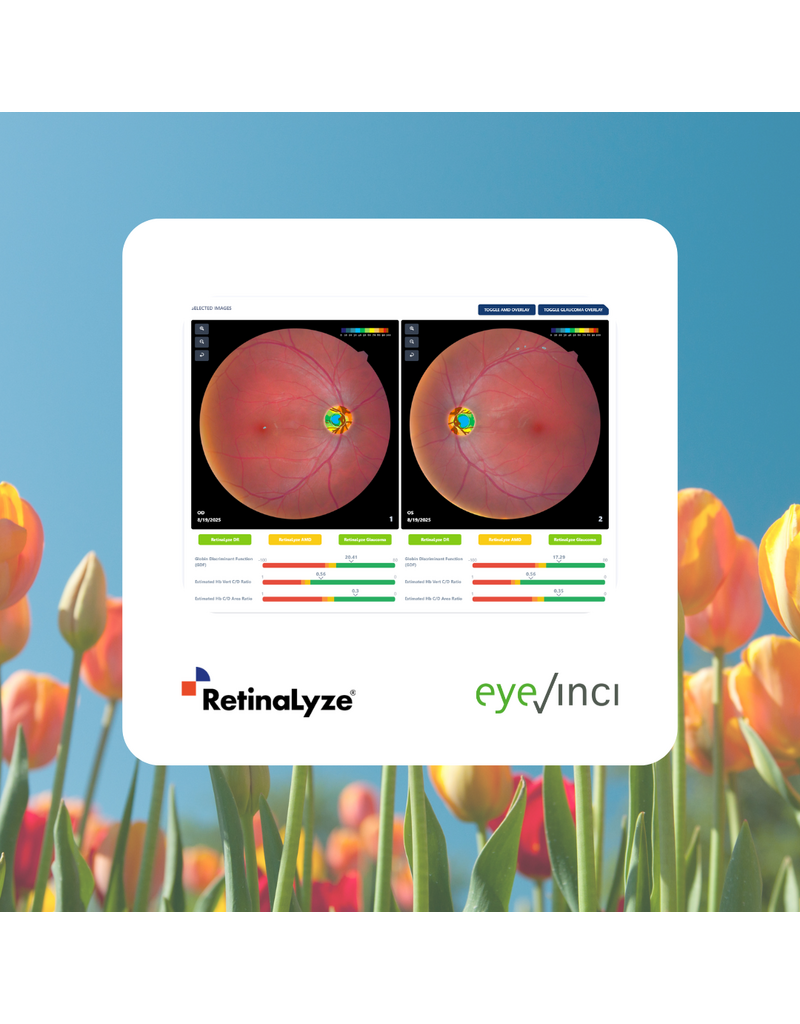 RetinaLyze RetinaLyze abonnement per maand