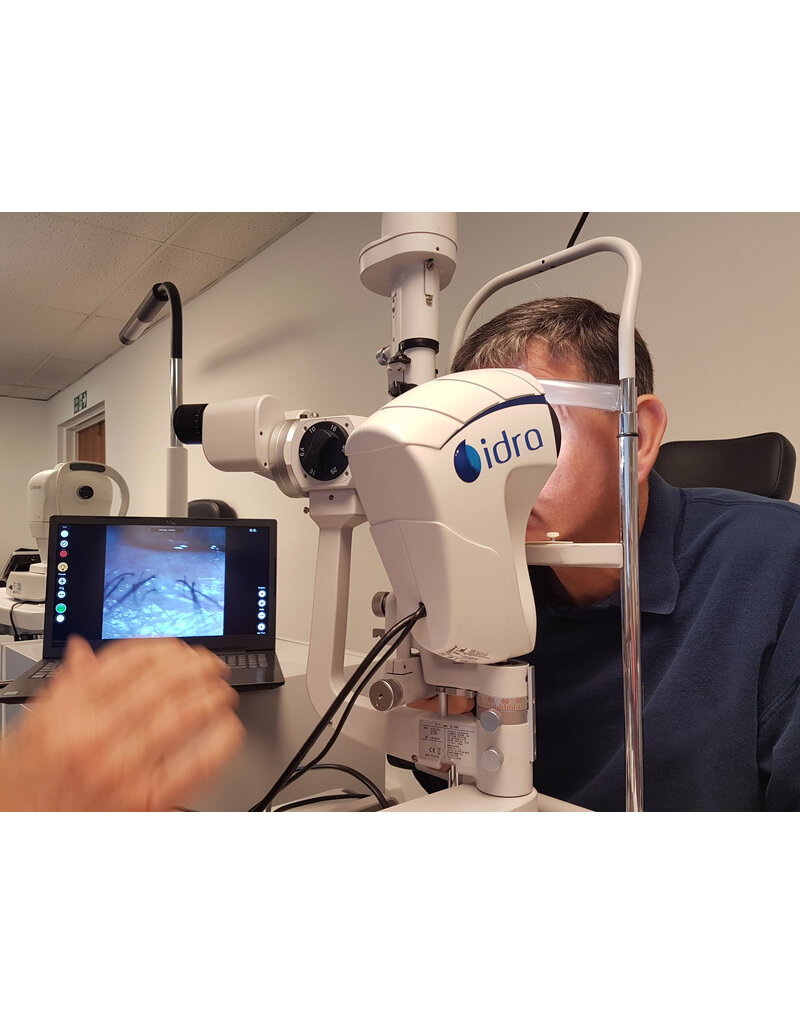 SBM IDRA- diagnostisch systeem droge ogen t.b.v spleetlamp