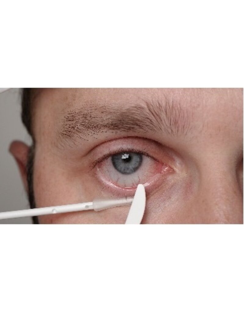 Oculus Oculus LidStick Dispenser Starter Kit - Complete set voor hygiënische en comfortabele ooglidhantering