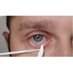 OCULUS LidStick® Navulling – 2 rollen (200 stuks) voor hygiënische ooglidmanipulatie
