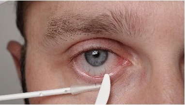 OCULUS LidStick® Navulling – 2 rollen (200 stuks) voor hygiënische ooglidmanipulatie