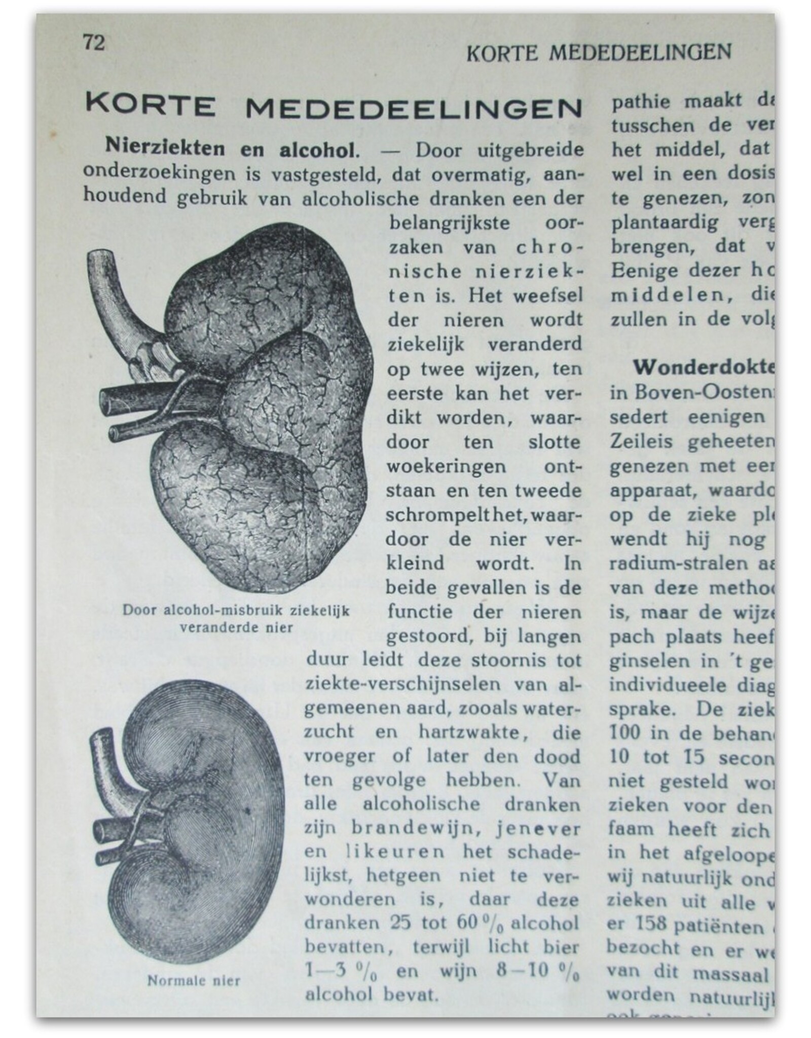 Dr. Med. J. Voorhoeve [ed.] - De Dokter in Huis. Populair Tijdschrift voor de Volksgezondheid. Elfde jaargang (1930)