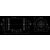 XXLselect Duct fan | very quiet | Wed 160mm