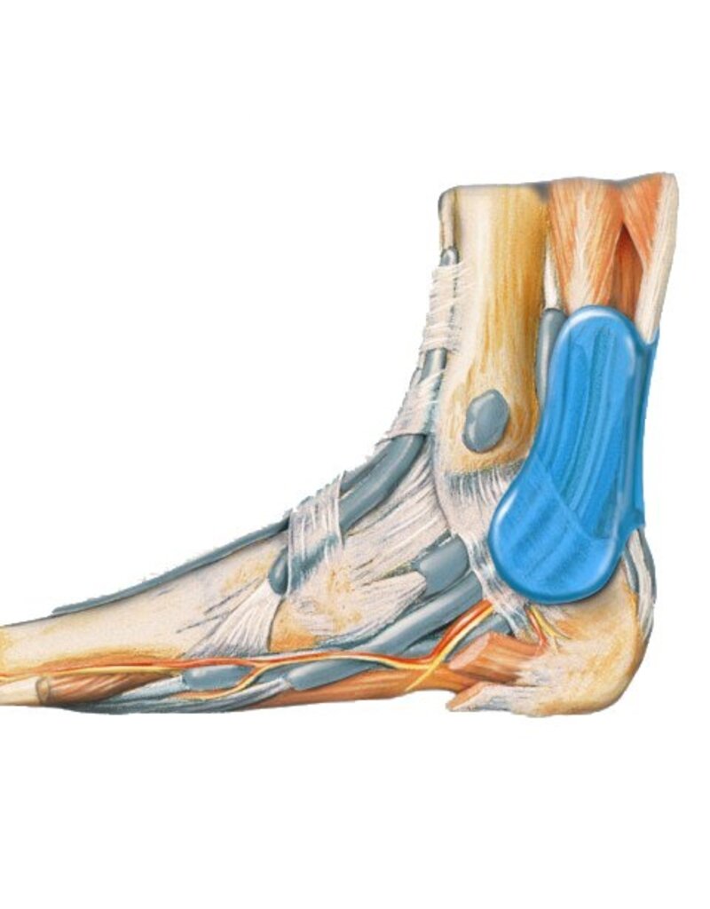 Bauerfeind Achillespees Brace Achillotrain