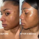 ROUTINELY | 27 TONE-EVENING TRANEXAMIC ACID SERUM