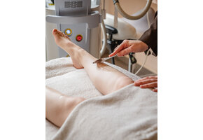 Laser Oberkörper (Rücken, Bauch, Brust) (8 Sitzungen) -50% | VIP Angebot