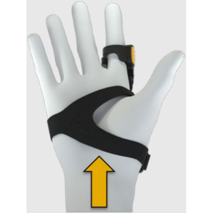 Zebra Zebra reserveband, Vervangende band voor montage op de rug van de hand