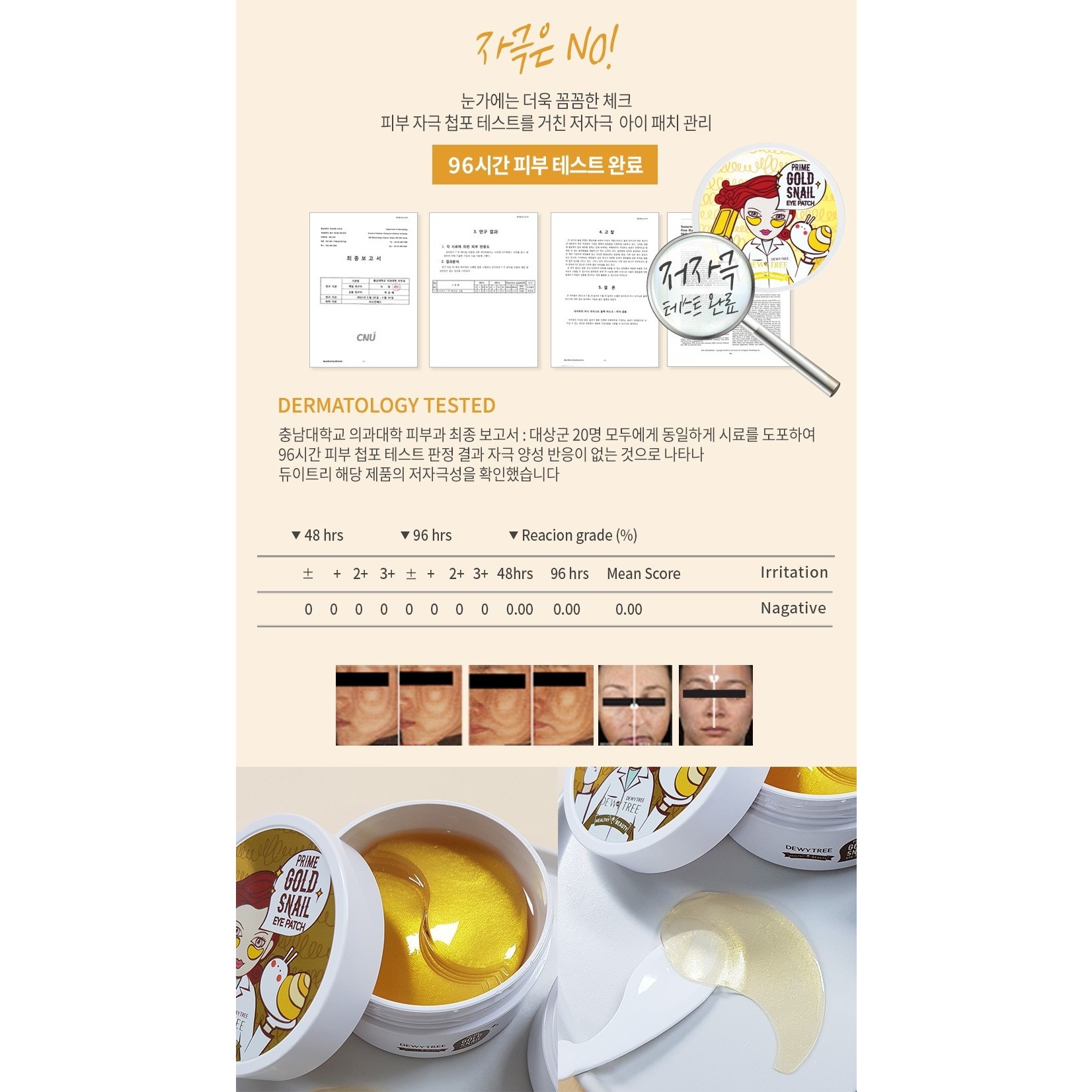 Prime Gold Snail Augenpads