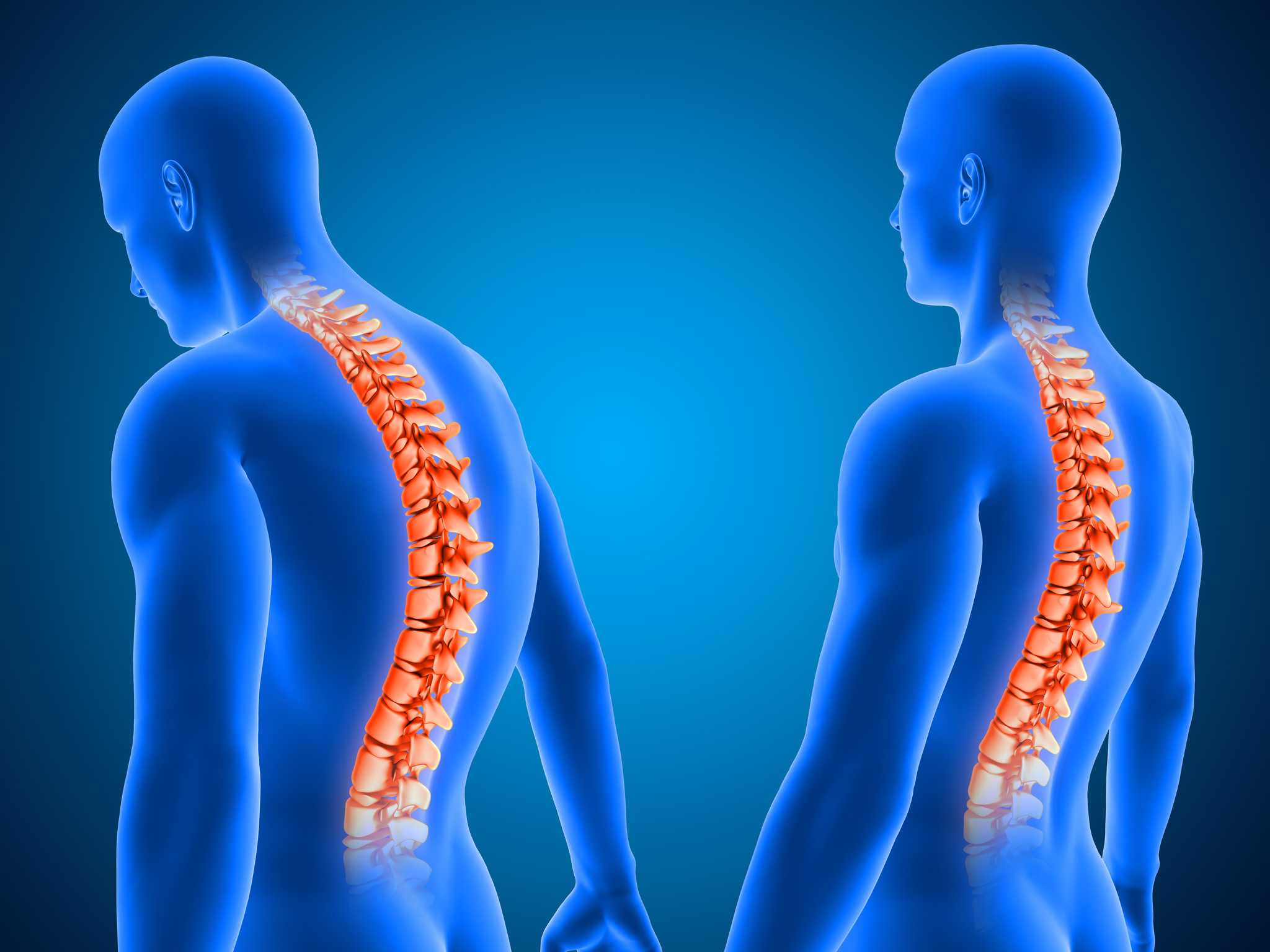 Back Pain: Are Back Braces Good For It?, Blog