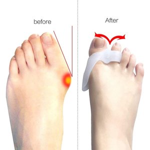 ACCESSORIES Bunion Supporter with Overlapping Toe