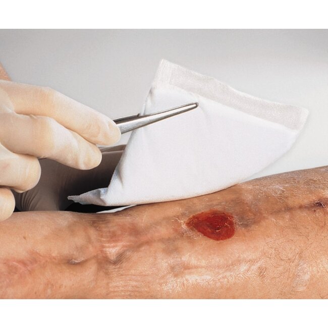 Vliwazell absorberend verband 10 x 10 cm steriel (60 stuks)