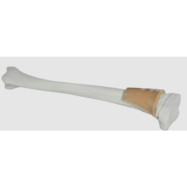 Teleflex Arrow Proximale tibia met huid, kind/adolescent