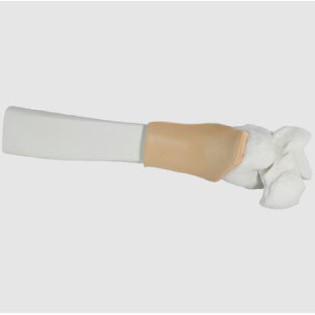 Teleflex Arrow Distale tibia met huid volwassene