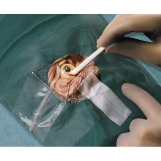 Lohmann & Rauscher Pro-ophta staafjes 66 x 5 mm steriel (400 stuks)