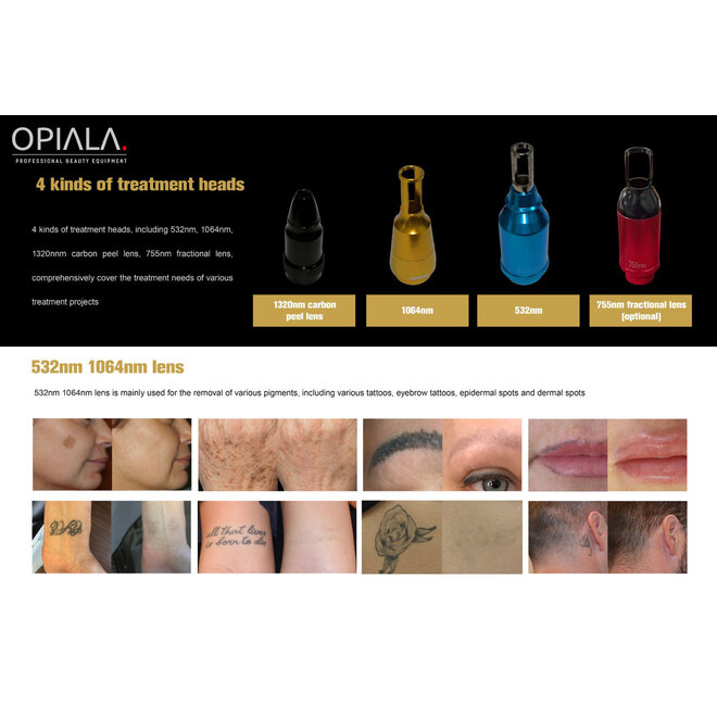 Q SWITCHED ND-YAG LASER