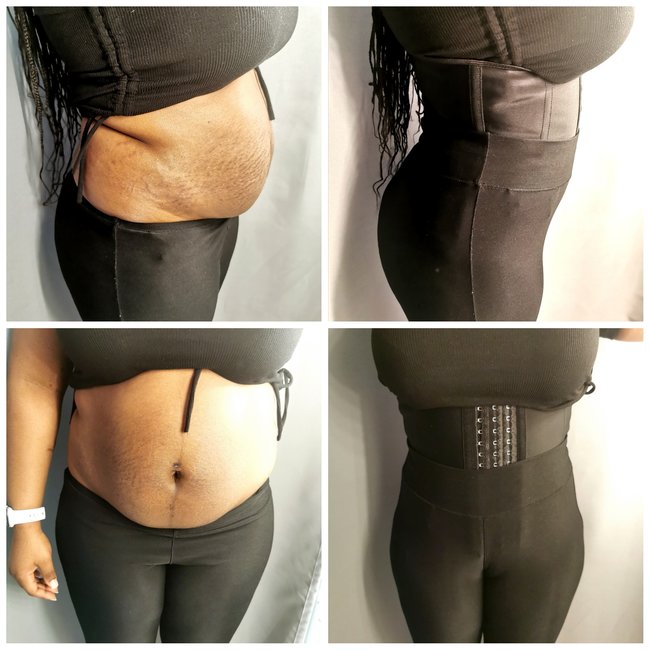 FABCHIQ The Original - Premium Latex Sport Waist Trainer