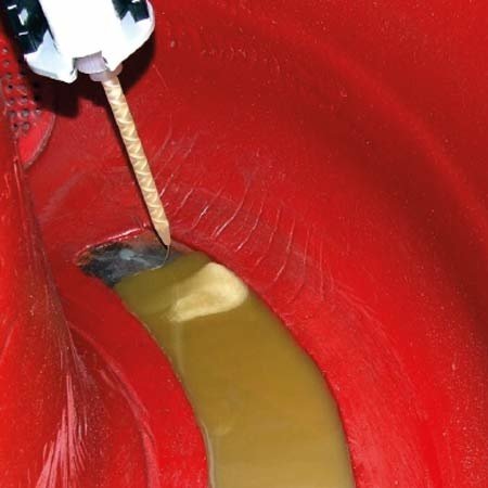 2-component repair system for PU wear protection