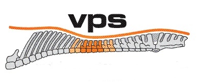 Wat is het Barefoot VPS systeem?