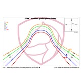 Soft Tree Gullet plate single