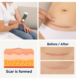 Alhydran Voor het beste herstel