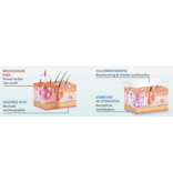 Alhydran Voor het beste herstel