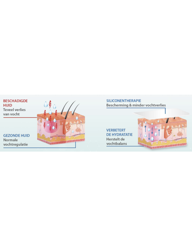 Alhydran Voor het beste herstel