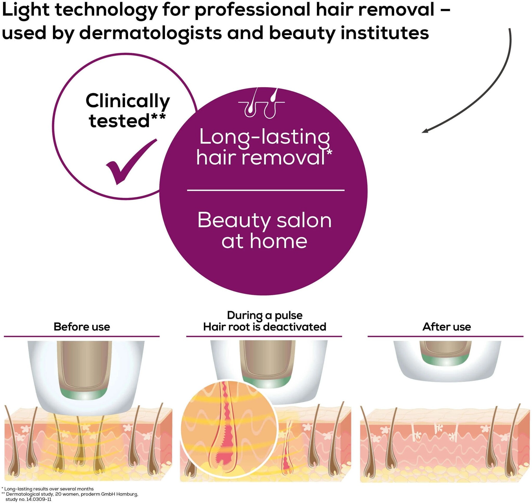 Beurer IPL PureSkinPro 5500 - Lichtontharingsapparaat