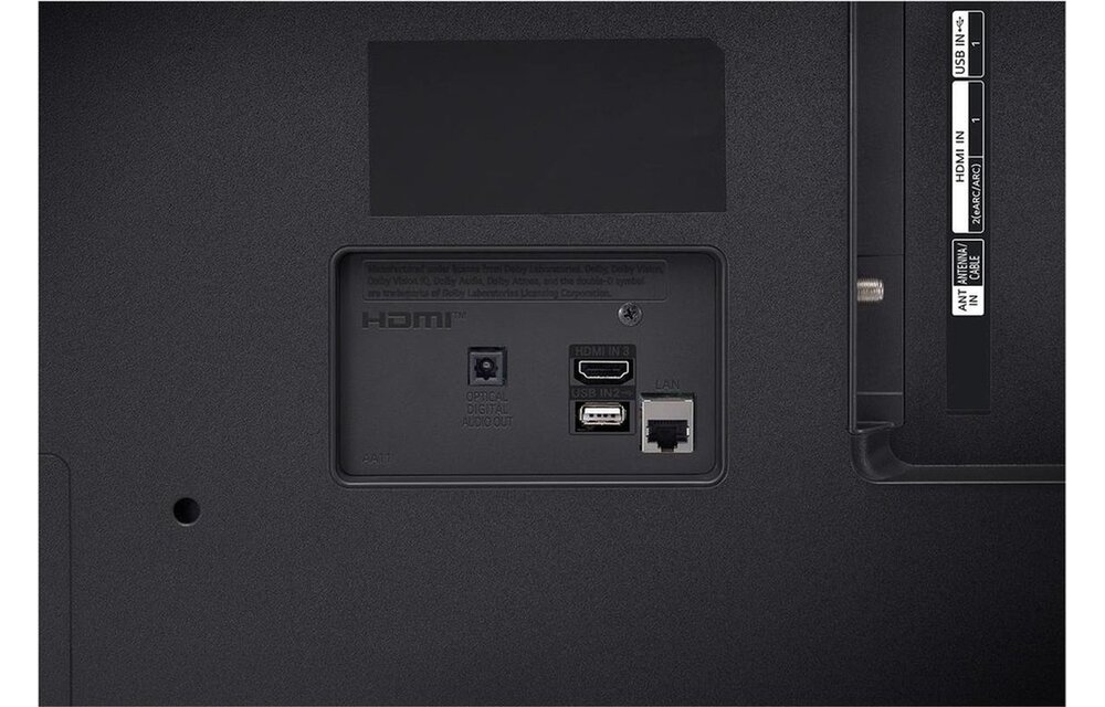 LG 43UR75006LK - LED TV