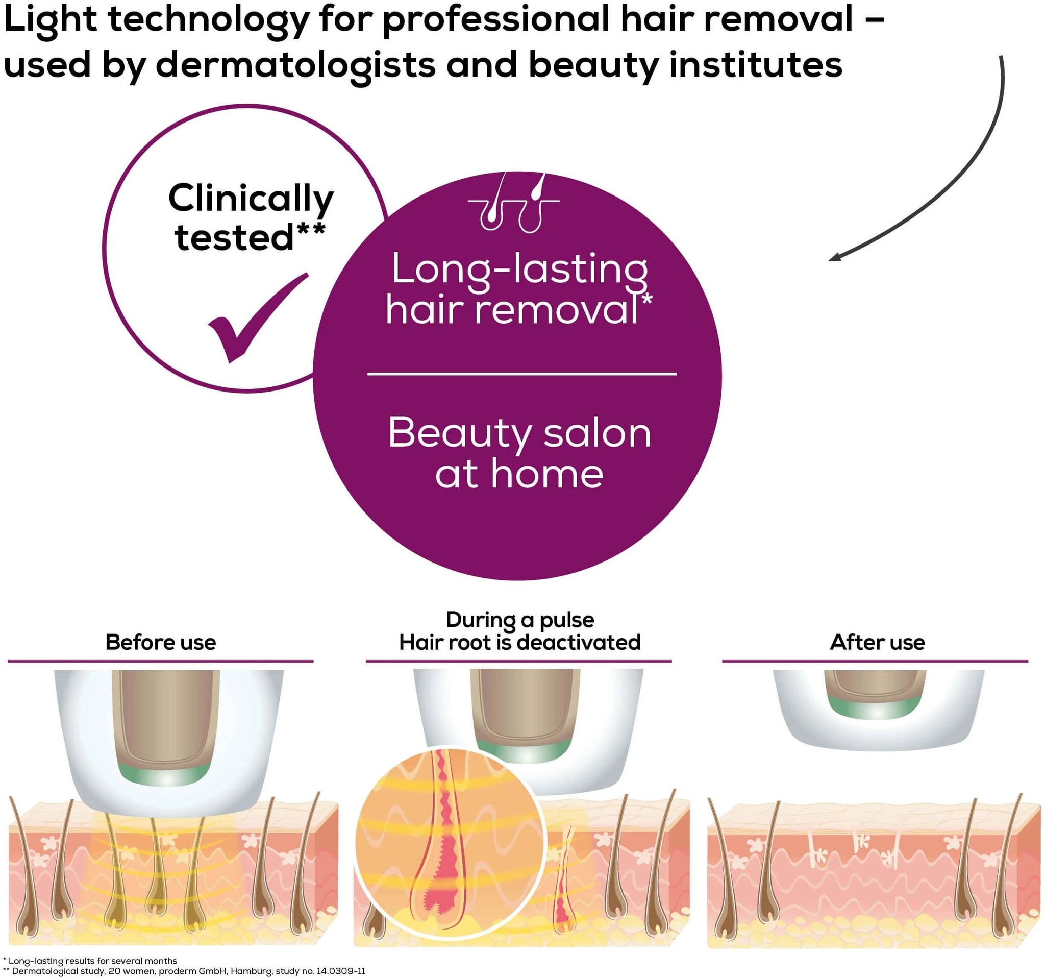 Beurer IPL VelvetSkinPro 8500 - Lichtontharingsapparaat