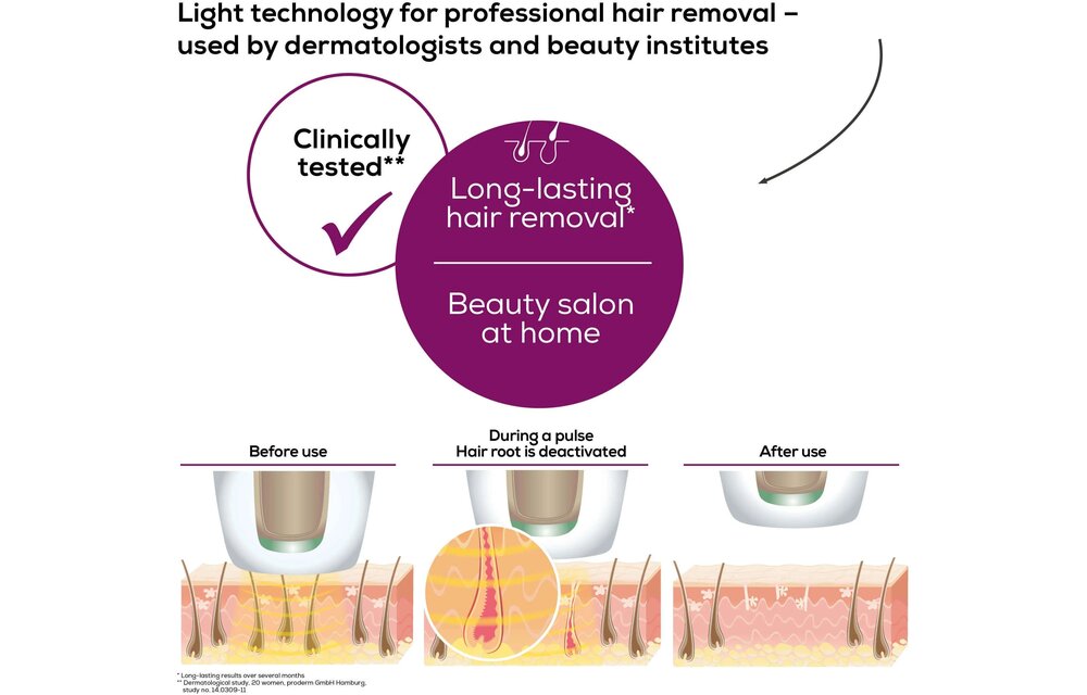 Beurer IPL Pure Skin Pro 5500 - Lichtontharingsapparaat